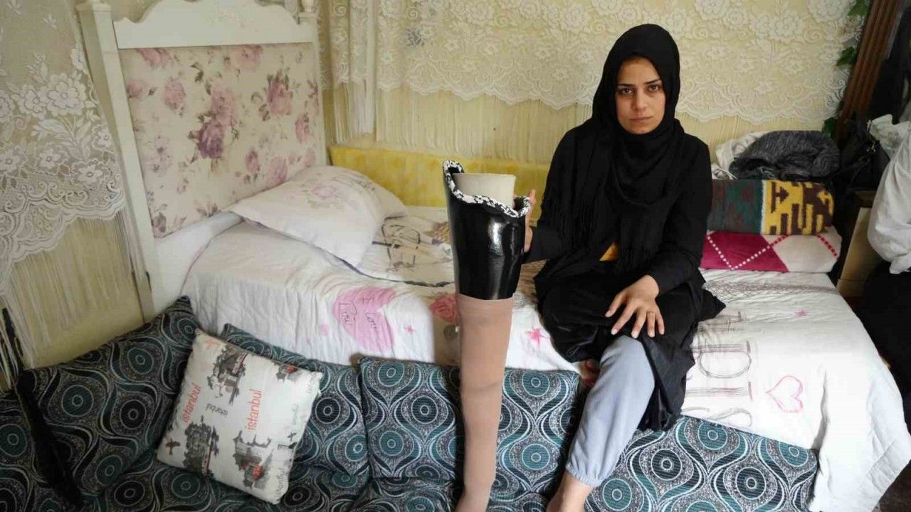 Kahramanmaraş merkezli büyük depremde bacağını kaybetti, eşi terk etti