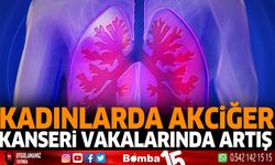 Kadınlarda akciğer kanseri vakalarında artış