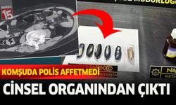 Cinsel organında sakladığı uyuşturucu ile yakalandı