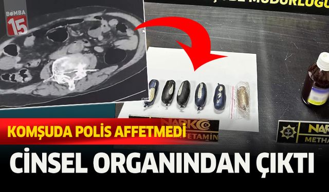 Cinsel organında sakladığı uyuşturucu ile yakalandı