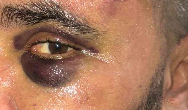 İsyeri sahibi dükkanında öldüresiye darp edildi